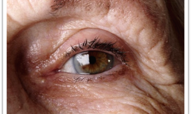 老人怎样保护眼睛免遭眼疾？