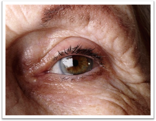 老人怎樣保護眼睛免遭眼疾？