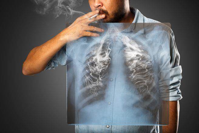 防控肺癌 切勿吸烟