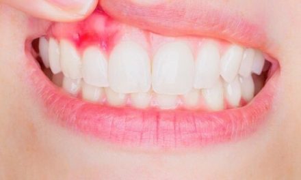 牙龈肿痛、出血，是牙周病吗 ?