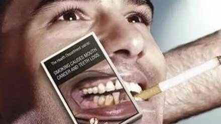 吸煙是牙周病的黑手