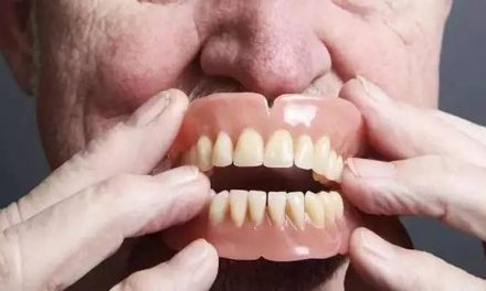 安裝假牙前必須知道的問題