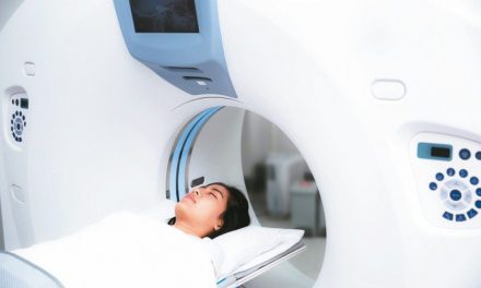 篩查早期肺癌，低劑量螺旋CT最佳