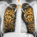 肺癌瞄準吸煙人士