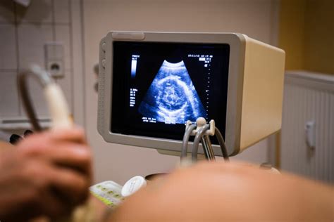 孕期超聲波檢查釋疑