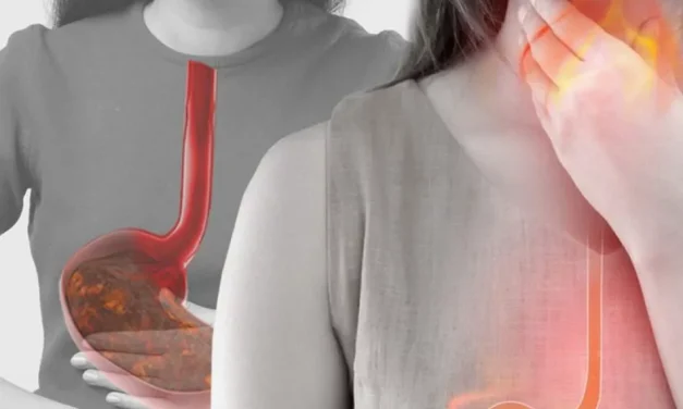 胃食管反流病需警惕食管癌