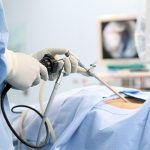 肺癌治療與微創手術