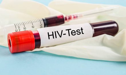 主動檢測HIV，為愛滋病防控添磚加瓦