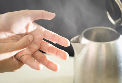 燒燙傷急救，你做對了嗎？