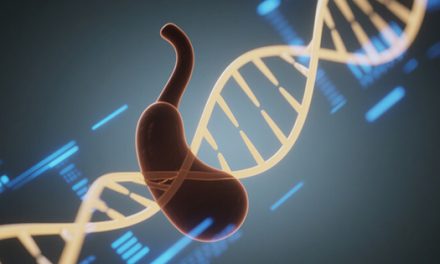 積極治療，提升胰腺癌長期生存