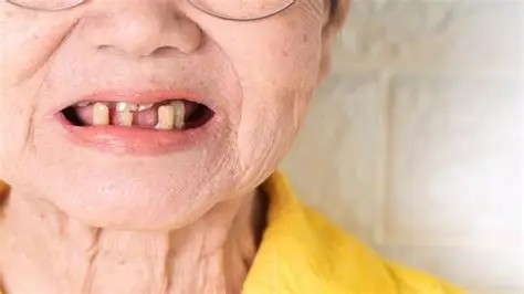 防治牙周病認識上需要糾錯